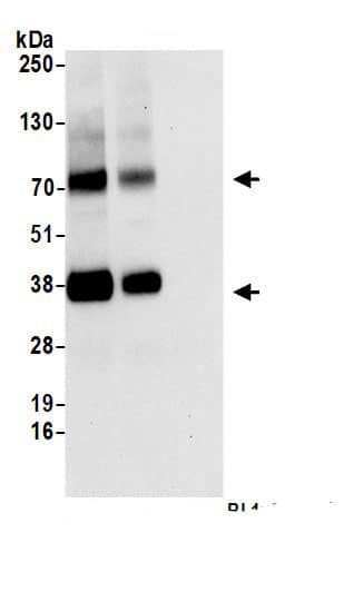 Immunoprecipitation:SLC16A3 AntibodyNBP3-29808] -Detection of human MCT4 by western blot of immunoprecipitates. Samples: Whole cell lysate (1.0 mg per IP reaction; 20% of IP loaded) from HeLa cells prepared using NETN lysis buffer. Antibodies: Affinity purified rabbit anti-MCT4 antibody NBP3-29808 (lot NBP3-29808-1) used for IP at 6 µg per reaction. MCT4 was also immunoprecipitated by rabbit anti-MCT4 antibody BL16601. For blotting immunoprecipitated MCT4, NBP3-29808 was used at 0.1 µg/ml. Detection: Chemiluminescence with an exposure time of 10 seconds.