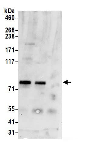 Immunoprecipitation:Mitofilin AntibodyNBP3-29812] -Detection of human IMMT by western blot of immunoprecipitates. Samples: Whole cell lysate (0.5 or 1.0 mg per IP reaction; 20% of IP loaded) from 293T cells prepared using NETN lysis buffer. Antibodies: Affinity purified rabbit anti-IMMT antibody NBP3-29812 (lot NBP3-29812-1) used for IP at 6 µg per reaction. IMMT was also immunoprecipitated by rabbit anti-IMMT.. For blotting immunoprecipitated IMMT, NBP3-29812 was used at 0.4 µg/ml. Detection: Chemiluminescence with an exposure time of 30 seconds.