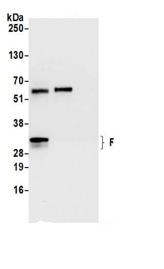 Immunoprecipitation:RPL8 AntibodyNBP3-29813] -Detection of human RPL8 by western blot of immunoprecipitates. Samples: Whole cell lysate (0.5 or 1.0 mg per IP reaction; 20% of IP loaded) from 293T cells prepared using NETN lysis buffer. Antibodies: Affinity purified rabbit anti-RPL8 antibody NBP3-29813 (lot NBP3-29813-1) used for IP at 6 µg per reaction. RPL8 was also immunoprecipitated by rabbit anti-RPL8.. For blotting immunoprecipitated RPL8, NBP3-29813 was used at 0.4 µg/ml. Detection: Chemiluminescence with an exposure time of 10 seconds.