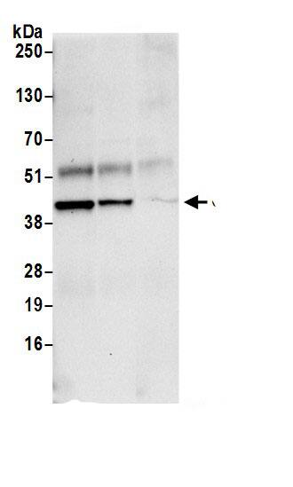 Immunoprecipitation:Glutaredoxin 3/GLRX3 AntibodyNBP3-29814] -Detection of human GLRX3 by western blot of immunoprecipitates. Samples: Whole cell lysate (0.5 or 1.0 mg per IP reaction; 20% of IP loaded) from 293T cells prepared using NETN lysis buffer. Antibodies: Affinity purified rabbit anti-GLRX3 antibody NBP3-29814 (lot NBP3-29814-1) used for IP at 6 µg per reaction. GLRX3 was also immunoprecipitated by rabbit anti-GLRX3.. For blotting immunoprecipitated GLRX3, NBP3-29814 was used at 0.4 µg/ml. Detection: Chemiluminescence with an exposure time of 30 seconds.