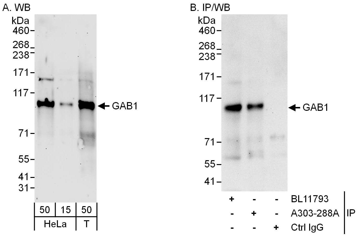 Western Blot:[NBP3-29815]-Detection of human GAB1 by western blot and immunoprecipitation. Samples: Whole cell lysate from HeLa and HEK293T cells. Antibodies: Affinity purified rabbit anti-GAB1 antibody used for WB at 0. 4 µg/ml and 1 µg/ml and used for IP at 6 µg/mg lysate. GAB1 was also immunoprecipitated by rabbit anti-GAB1 antibody , which recognizes an upstream epitope. Detection: Chemiluminescence with exposure times of 3 minutes and 30 seconds.