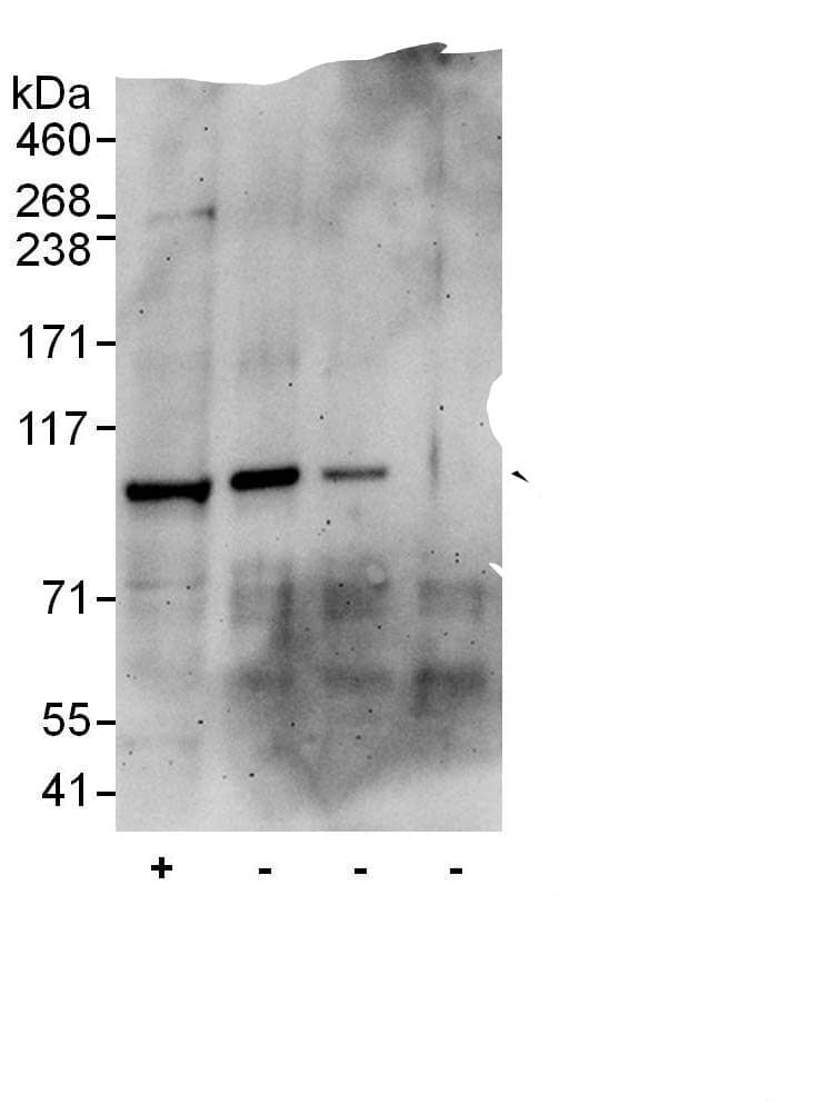 Immunoprecipitation:VAV3 AntibodyNBP3-29818] -Detection of human VAV3 by western blot of immunoprecipitation. Samples: Whole cell lysate (50 µg for input; 1 mg for IP, 20% of IP loaded) from Jurkat cells. Antibodies: Affinity purified rabbit anti-VAV3 antibody NBP3-29818 used for WB at 1 µg/ml and used for IP at 6 µg/mg lysate. VAV3 was also immunoprecipitated by rabbit anti-VAV3 antibody , which recognizes a downstream epitope. Detection: Chemiluminescence with an exposure time of 3 minutes.