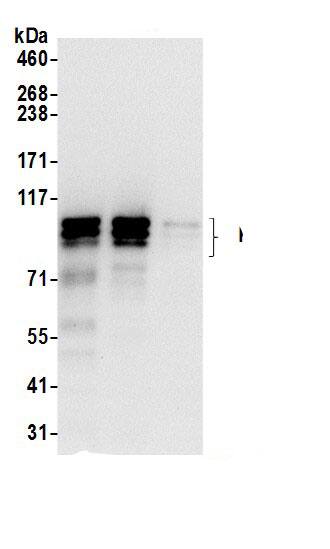 Immunoprecipitation:KRI1 AntibodyNBP3-29819] -Detection of human KRI1 by western blot of immunoprecipitates. Samples: Whole cell lysate (0.5 or 1.0 mg per IP reaction; 20% of IP loaded) from 293T cells prepared using NETN lysis buffer. Antibodies: Affinity purified rabbit anti-KRI1 antibody NBP3-29819 (lot NBP3-29819-1) used for IP at 6 µg per reaction. KRI1 was also immunoprecipitated by rabbit anti-KRI1 antibody. For blotting immunoprecipitated KRI1, NBP3-29819 was used at 0.4 µg/ml. Detection: Chemiluminescence with an exposure time of 3 seconds.