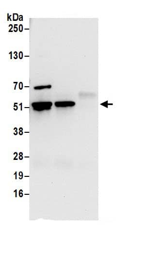 Immunoprecipitation:RUVBL1 AntibodyNBP3-29820] -Detection of human RUVBL1 by western blot of immunoprecipitates. Samples: Whole cell lysate (0.5 or 1.0 mg per IP reaction; 20% of IP loaded) from 293T cells prepared using NETN lysis buffer. Antibodies: Affinity purified rabbit anti-RUVBL1 antibody NBP3-29820 (lot NBP3-29820-1) used for IP at 6 µg per reaction. RUVBL1 was also immunoprecipitated by rabbit anti-RUVBL1.. For blotting immunoprecipitated RUVBL1, NBP3-29820 was used at 0.4 µg/ml. Detection: Chemiluminescence with an exposure time of 10 seconds.