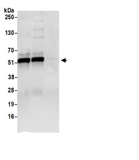 Immunoprecipitation:Adenylosuccinate Lyase AntibodyNBP3-29821] -Detection of human Adenylosuccinate Lyase/ADSL by western blot of immunoprecipitates. Samples: Whole cell lysate (0.5 or 1.0 mg per IP reaction; 20% of IP loaded) from 293T cells prepared using NETN lysis buffer. Antibody: Affinity purified rabbit anti-Adenylosuccinate Lyase/ADSL antibody NBP3-29821 (lot NBP3-29821-1) used for IP at 6 µg per reaction. Adenylosuccinate Lyase/ADSL was also immunoprecipitated by rabbit anti-Adenylosuccinate Lyase/ADSL antibody BL18708. For blotting immunoprecipitated Adenylosuccinate Lyase/ADSL, NBP3-29821 was used at 0.4 µg/ml. Detection: Chemiluminescence with an exposure time of 10 seconds.