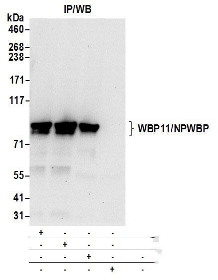 Immunoprecipitation:[NBP3-29822]-Detection of human WBP11/NPWBP by western blot of immunoprecipitates. Samples: Whole cell lysate from HeLa cells prepared using NETN lysis buffer. Antibodies: Affinity purified rabbit anti-WBP11/NPWBP antibody used for IP at 6 µg per reaction. WBP11/NPWBP was also immunoprecipitated by rabbit anti-WBP11/NPWBP antibodies and. For blotting immunoprecipitated WBP11/NPWBP, was used at 1 µg/ml. Detection: Chemiluminescence with an exposure time of 30 seconds.