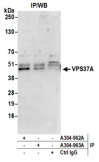 Immunoprecipitation:[NBP3-29823]-Detection of human VPS37A by western blot of immunoprecipitates. Samples: Whole cell lysate from 293T cells prepared using NETN lysis buffer. Antibodies: Affinity purified rabbit antibody used for IP at 6 µg per reaction. VPS37A was also immunoprecipitated by rabbit antibody. For blotting immunoprecipitated VPS37A, was used at 0. 4 µg/ml. Detection: Chemiluminescence with an exposure time of 30 seconds.