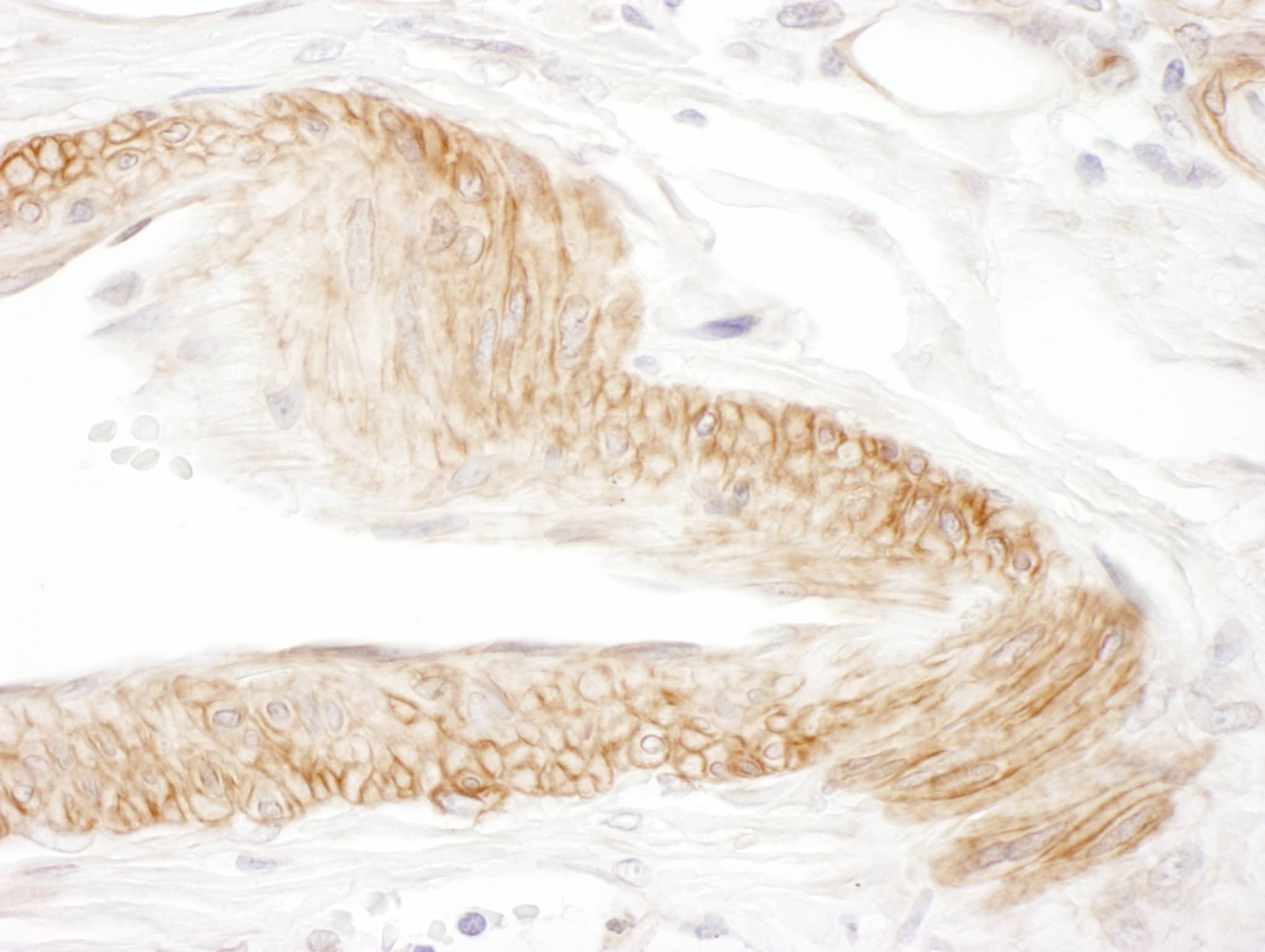 Immunohistochemistry;JAM-C Antibody[NBP3-29827]Detection of human JAM-C by immunohistochemistry. Sample: FFPE section of human blood vessel. Antibody: Affinity purified rabbit anti-JAM-C  used at a dilution of 1:1,000 . Detection: DAB. Counterstain: Hematoxylin .