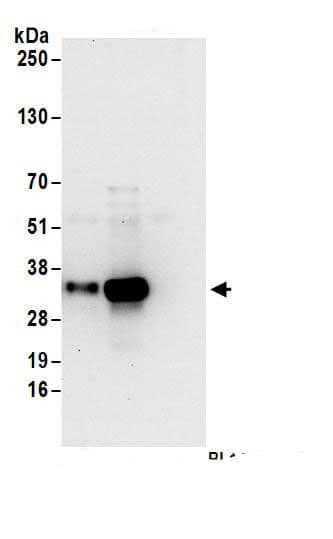 Immunoprecipitation:Thymidylate Synthase AntibodyNBP3-29829] -Detection of human TS by western blot of immunoprecipitates. Samples: Whole cell lysate (1 mg for IP; 20% of IP loaded) from Jurkat cells. Antibodies: Affinity purified rabbit anti-TS antibody NBP3-29829 (lot NBP3-29829-1) used for IP at 6 µg/mg lysate. TS was also immunoprecipitated by rabbit anti-TS antibody for blotting immunoprecipitated TS, NBP3-29829 was used at 1 µg/ml. Detection: Chemiluminescence with an exposure time of 10 seconds.