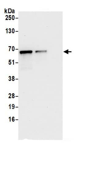 Immunoprecipitation:IFIT3 AntibodyNBP3-29832] -Detection of human IFIT3 by western blot of immunoprecipitates. Samples: Whole cell lysate (0.5 or 1.0 mg per IP reaction; 20% of IP loaded) from HeLa cells prepared using NETN lysis buffer. Antibodies: Affinity purified rabbit anti-IFIT3 antibody NBP3-29832 (lot NBP3-29832-1) used for IP at 6 µg per reaction. IFIT3 was also immunoprecipitated by rabbit anti-IFIT3.. For blotting immunoprecipitated IFIT3, NBP3-29832 was used at 0.4 µg/ml. Detection: Chemiluminescence with an exposure time of 10 seconds.