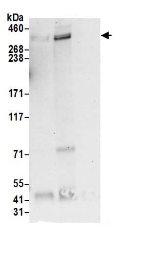 Immunoprecipitation:Flamingo homolog 1/CELSR3 AntibodyNBP3-29833] -Detection of human CELSR3 by western blot of immunoprecipitates. Samples: Whole cell lysate (0.5 or 1.0 mg per IP reaction; 20% of IP loaded) from HeLa cells prepared using NETN lysis buffer. Antibodies: Affinity purified rabbit anti-CELSR3 antibody NBP3-29833 (lot NBP3-29833-1) used for IP at 6 µg per reaction. CELSR3 was also immunoprecipitated by rabbit anti-CELSR3 antibody. For blotting immunoprecipitated CELSR3, NBP3-29833 was used at 1 µg/ml. Detection: Chemiluminescence with an exposure time of 30 seconds.