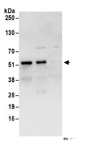 Immunoprecipitation:FAM53C AntibodyNBP3-29834] -Detection of human FAM53C by western blot of immunoprecipitates. Samples: Whole cell lysate (1 mg for IP; 20% of IP loaded) from HeLa cells. Antibodies: Affinity purified rabbit anti-FAM53C antibody NBP3-29834 (lot NBP3-29834-1) used for IP at 6 µg/mg lysate. FAM53C was also immunoprecipitated by rabbit anti-FAM53C antibody for blotting immunoprecipitated FAM53C, NBP3-29834 was used at 1 µg/ml. Detection: Chemiluminescence with an exposure time of 30 seconds.