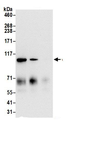 Immunoprecipitation:alpha Glucosidase 2 AntibodyNBP3-29835] -Detection of human GANAB by western blot of immunoprecipitates. Samples: Whole cell lysate (0.5 or 1.0 mg per IP reaction; 20% of IP loaded) from 293T cells prepared using NETN lysis buffer. Antibodies: Affinity purified rabbit anti-GANAB antibody NBP3-29835 (lot NBP3-29835-1) used for IP at 6 µg per reaction. GANAB was also immunoprecipitated by rabbit anti-GANAB.. For blotting immunoprecipitated GANAB, A304-004A was used at 0.4 µg/ml. Detection: Chemiluminescence with an exposure time of 10 seconds.