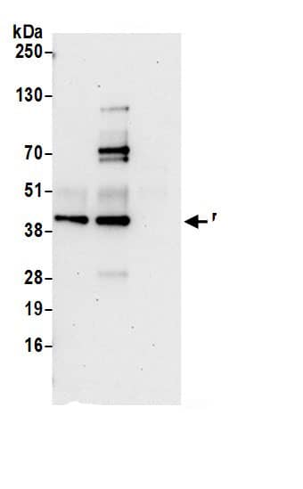 Immunoprecipitation:DRG1 AntibodyNBP3-29837] -Detection of human DRG1 by western blot of immunoprecipitates. Samples: Whole cell lysate (0.5 or 1.0 mg per IP reaction; 20% of IP loaded) from 293T cells prepared using NETN lysis buffer. Antibodies: Affinity purified rabbit anti-DRG1 antibody NBP3-29837 (lot NBP3-29837-1) used for IP at 6 µg per reaction. DRG1 was also immunoprecipitated by rabbit anti-DRG1.. For blotting immunoprecipitated DRG1, NBP3-29837 was used at 1 µg/ml. Detection: Chemiluminescence with an exposure time of 30 seconds.