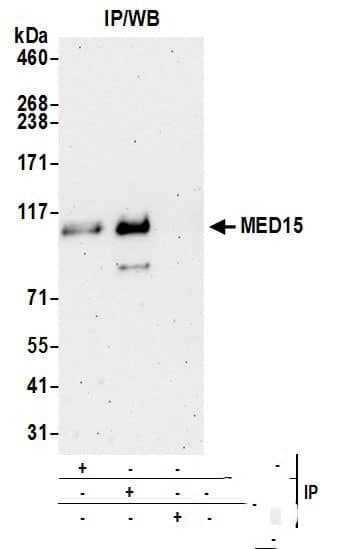 Immunoprecipitation:[NBP3-29838]-Detection of human MED15 by western blot of immunoprecipitates. Samples: Whole cell lysate from HeLa cells prepared using NETN lysis buffer. Antibodies: Affinity purified rabbit anti-MED15 antibody used for IP at 3 µg per reaction. MED15 was also immunoprecipitated by rabbit anti-MED15 antibody. For blotting immunoprecipitated MED15, was used at 1 µg/ml. Detection: Chemiluminescence with an exposure time of 75 seconds.