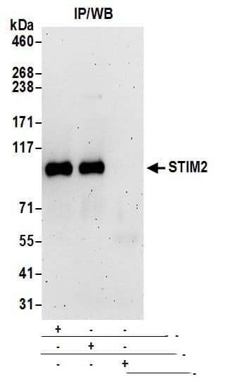 Immunoprecipitation:[NBP3-29841]-Detection of human STIM2 by western blot of immunoprecipitates. Samples: Whole cell lysate prepared using NETN buffer from HeLa cells. Antibodies: Affinity purified rabbit anti-STIM2 antibody used for IP at 6 µg per reaction. STIM2 was also immunoprecipitated by rabbit anti-STIM2 antibody. For blotting immunoprecipitated STIM2, was used at 1 µg/ml. Detection: Chemiluminescence with an exposure time of 3 minutes.