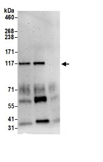 Immunoprecipitation Phosphorylase B Antibody