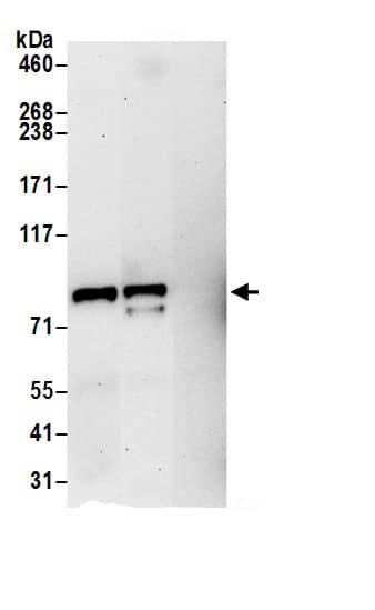 Immunoprecipitation:Aconitase 2 AntibodyNBP3-29844] -Detection of human ACO2 by western blot of immunoprecipitates. Samples: Whole cell lysate (0.5 or 1.0 mg per IP reaction; 20% of IP loaded) from 293T cells prepared using NETN lysis buffer. Antibodies: Affinity purified rabbit anti-ACO2 antibody NBP3-29844 (lot NBP3-29844-1) used for IP at 6 µg per reaction. ACO2 was also immunoprecipitated by rabbit anti-ACO2.. For blotting immunoprecipitated ACO2, NBP3-29844 was used at 1 µg/ml. Detection: Chemiluminescence with an exposure time of 30 seconds.