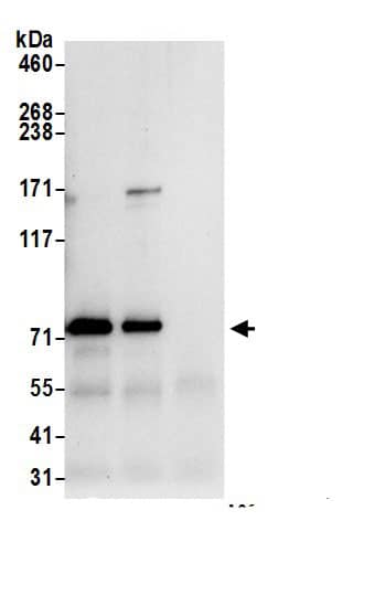 Immunoprecipitation:DPP3 AntibodyNBP3-29845] -Detection of human DPP3 by western blot of immunoprecipitates. Samples: Whole cell lysate (0.5 or 1.0 mg per IP reaction; 20% of IP loaded) from 293T cells prepared using NETN lysis buffer. Antibodies: Affinity purified rabbit anti-DPP3 antibody NBP3-29845 (lot NBP3-29845-1) used for IP at 6 µg per reaction. DPP3 was also immunoprecipitated by rabbit anti-DPP3.. For blotting immunoprecipitated DPP3, NBP3-29845 was used at 1 µg/ml. Detection: Chemiluminescence with an exposure time of 10 seconds.