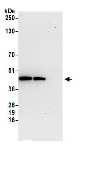 Immunoprecipitation:SUCLA2 AntibodyNBP3-29850] -Detection of human SUCLA2 by western blot of immunoprecipitates. Samples: Whole cell lysate (0.5 or 1.0 mg per IP reaction; 20% of IP loaded) from 293T cells prepared using NETN lysis buffer. Antibodies: Affinity purified rabbit anti-SUCLA2 antibody NBP3-29850 (lot NBP3-29850-1) used for IP at 6 µg per reaction. SUCLA2 was also immunoprecipitated by rabbit anti-SUCLA2.. For blotting immunoprecipitated SUCLA2, NBP3-29850 was used at 1 µg/ml. Detection: Chemiluminescence with an exposure time of 30 seconds.