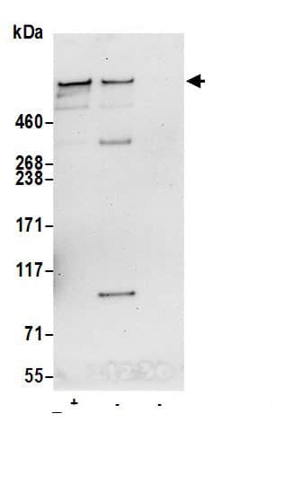 Immunoprecipitation:Nesprin 2 AntibodyNBP3-29852] -Detection of human SYNE2 by western blot of immunoprecipitates. Samples: Whole cell lysate (0.5 or 1.0 mg per IP reaction; 20% of IP loaded) from HeLa cells prepared using NETN lysis buffer. Antibodies: Affinity purified rabbit anti-SYNE2 antibody NBP3-29852 (lot NBP3-29852-1) used for IP at 6 µg per reaction. SYNE2 was also immunoprecipitated by rabbit anti-SYNE2.. For blotting immunoprecipitated SYNE2, NBP3-29852 was used at 1 µg/ml. Detection: Chemiluminescence with an exposure time of 30 seconds.