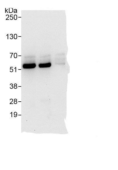 Immunoprecipitation:SPTLC1 AntibodyNBP3-29854] -Detection of human SPTLC1 by western blot of immunoprecipitates. Samples: Whole cell lysate (1 mg for IP, 20% of IP loaded)from HeLa cells. Antibodies: Affinity purified rabbit anti-SPTLC1 antibody NBP3-29854 (lot NBP3-29854-1) used for IP at 6 µg/mg lysate. SPTLC1 was also immunoprecipitated by rabbit anti-SPTLC1., which recognizes an upstream epitope. For blotting immunoprecipitated SPTLC1, NBP3-29854 was used at 1.0 µg/ml. Detection: Chemiluminescence with exposure time of 30 seconds.