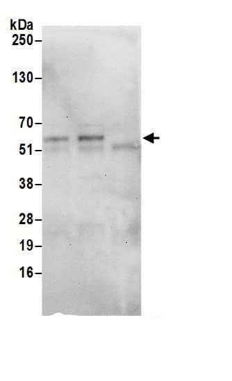 Immunoprecipitation:SAAL1 AntibodyNBP3-29855] -Detection of human SAAL1 by western blot of immunoprecipitates. Samples: Whole cell lysate (0.5 or 1.0 mg per IP reaction; 20% of IP loaded) from 293T cells prepared using NETN lysis buffer. Antibodies: Affinity purified rabbit anti-SAAL1 antibody NBP3-29855 (lot NBP3-29855-1) used for IP at 6 µg per reaction. SAAL1 was also immunoprecipitated by rabbit anti-SAAL1 antibody . For blotting immunoprecipitated SAAL1, NBP3-29855 was used at 0.1 µg/ml. Detection: Chemiluminescence with an exposure time of 30 seconds.