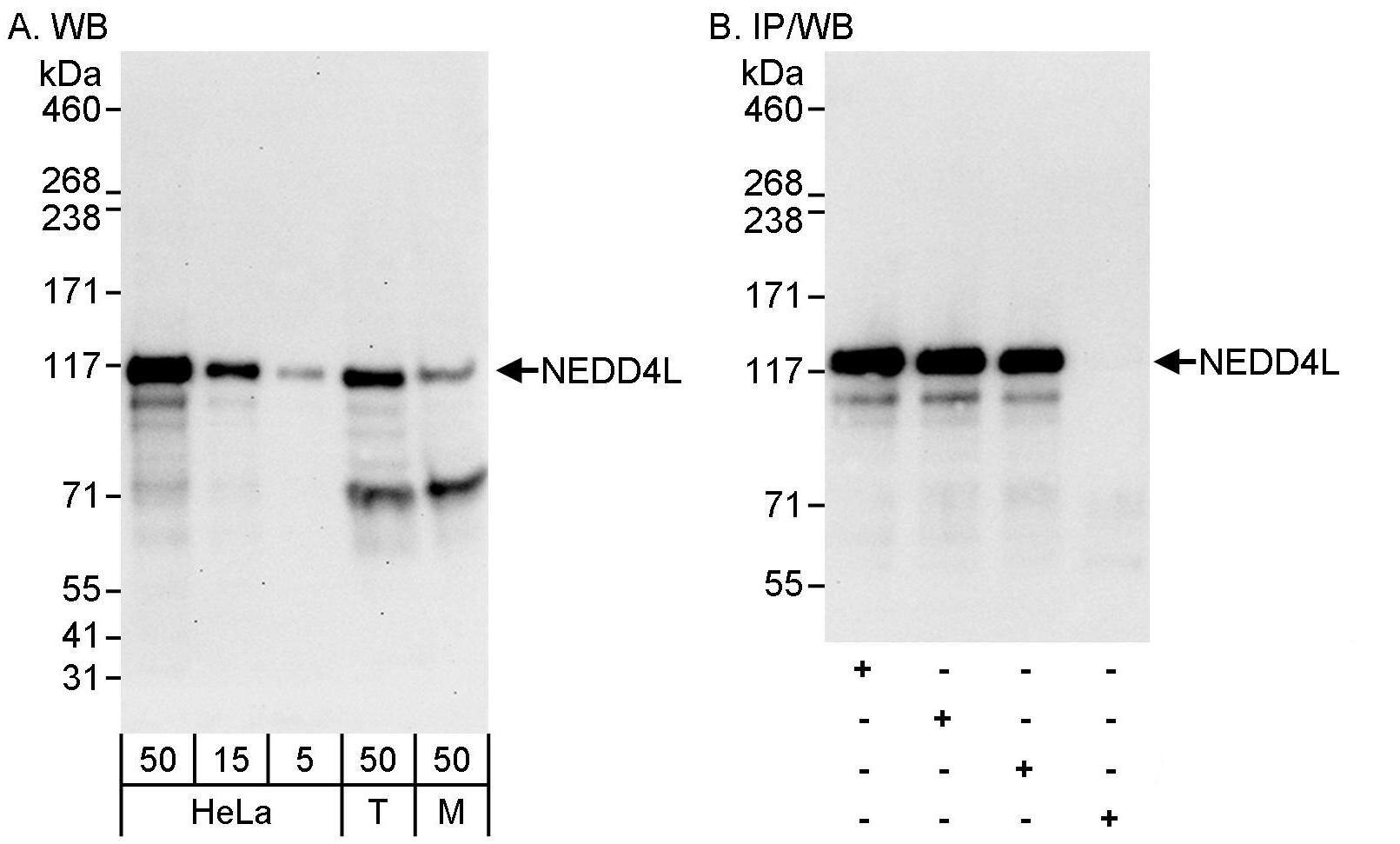 Western Blot:[NBP3-29856]-Detection of human and mouse NEDD4L by western blot and immunoprecipitation. Samples: Whole cell lysate from HeLa , HEK293T , and mouse NIH 3T3 cells. Antibodies: Affinity purified rabbit anti-NEDD4L antibody used for WB at 0. 04 µg/ml and 0. 4 µg/ml and used for IP at 3 µg/mg lysate. NEDD4L was also immunoprecipitated by rabbit anti-NEDD4L antibodies and , which recognize upstream epitopes. Detection: Chemiluminescence with exposure times of 30 second and 10 seconds.