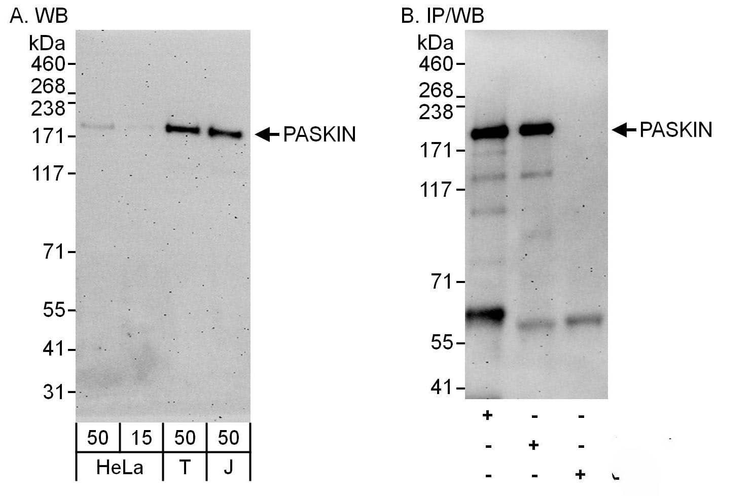 Western Blot:[NBP3-29857]-Detection of human PASKIN by western blot and immunoprecipitation. Samples: Whole cell lysate from HeLa , HEK293T and Jurkat cells. Antibodies: Affinity purified rabbit anti-PASKIN antibody used for WB at 0. 04 µg/ml and 0. 4 µg/ml and used for IP at 6 µg/mg lysate. PASKIN was also immunoprecipitated by rabbit anti-PASKIN antibody , which recognizes a downstream epitope. Detection: Chemiluminescence with exposure times of 3 minutes.