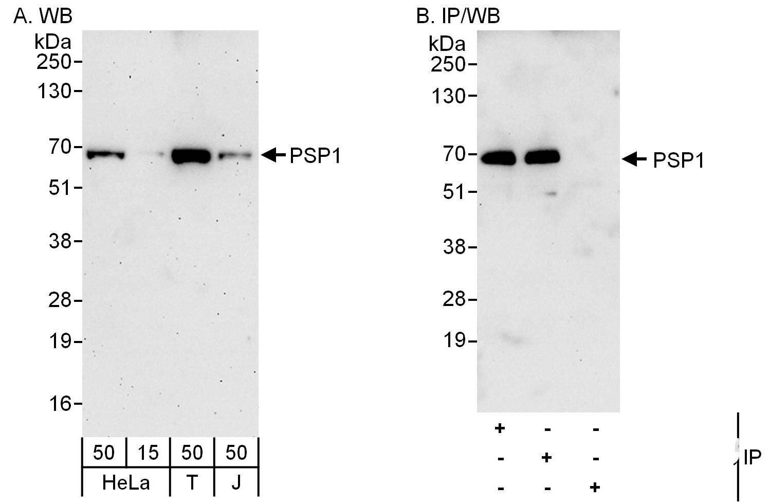Western Blot:[NBP3-29858]-Detection of human PSP1 by western blot and immunoprecipitation. Samples: Whole cell lysate from HeLa , HEK293T and Jurkat cells. Antibodies: Affinity purified rabbit anti-PSP1 antibody used for WB at 0. 04 µg/ml and 0. 4 µg/ml and used for IP at 6 µg/mg lysate. PSP1 was also immunoprecipitated by rabbit anti-PSP1 antibody , which recognizes an upstream epitope. Detection: Chemiluminescence with exposure times of 3 minutes and 30 seconds.