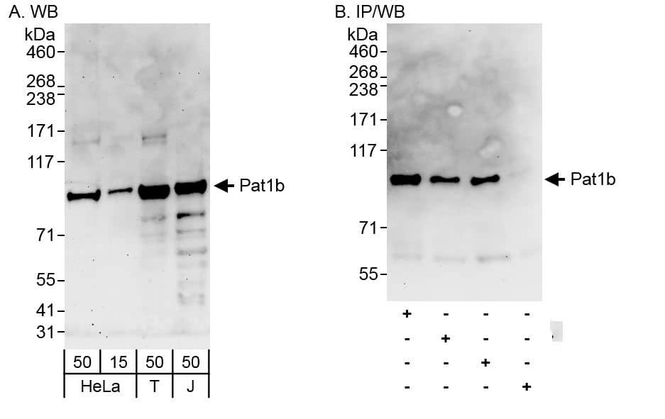 Western Blot:[NBP3-29859]-Detection of human Pat1b by western blot and immunoprecipitation. Samples: Whole cell lysate from HeLa , HEK293T and Jurkat cells. Antibodies: Affinity purified rabbit anti-Pat1b antibody used for WB at 0. 1 µg/ml and 1 µg/ml and used for IP at 6 µg/mg lysate. Pat1b was also immunoprecipitated by rabbit anti-Pat1b antibodies and , which recognize downstream epitopes. Detection: Chemiluminescence with exposure times of 3 minutes and 30 seconds.