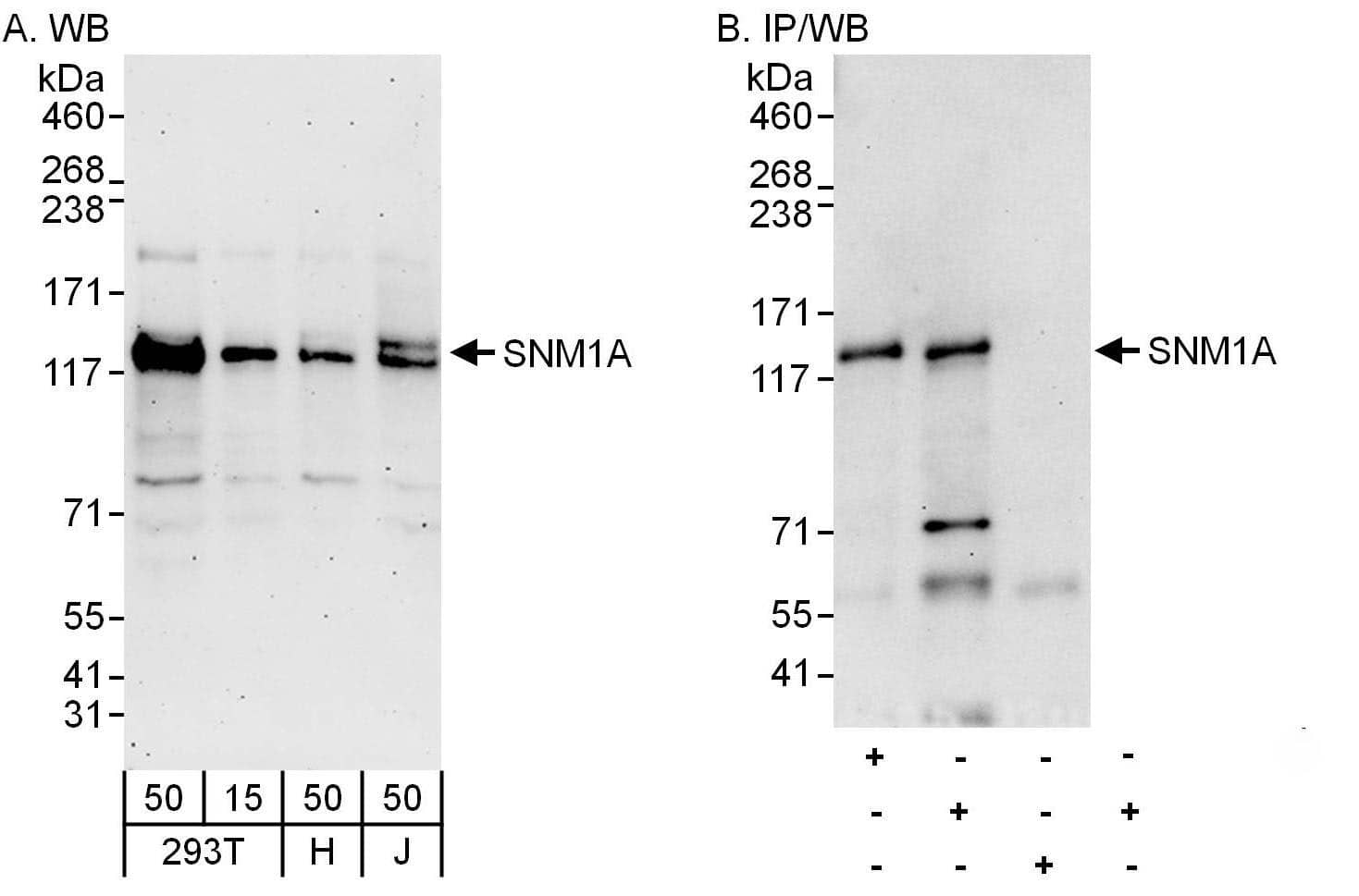 Western Blot:[NBP3-29860]-Detection of human SNM1A by western blot and immunoprecipitation. Samples: Whole cell lysate from HEK293T , HeLa and Jurkat cells. Antibodies: Affinity purified rabbit antibody used for WB at 0. 1 µg/ml and 1 µg/ml and used for IP at 6 µg/mg lysate. SNM1A was also immunoprecipitated by rabbit antibody , which recognizes an upstream epitope. Detection: Chemiluminescence with exposure times of 3 minutes and 30 seconds.