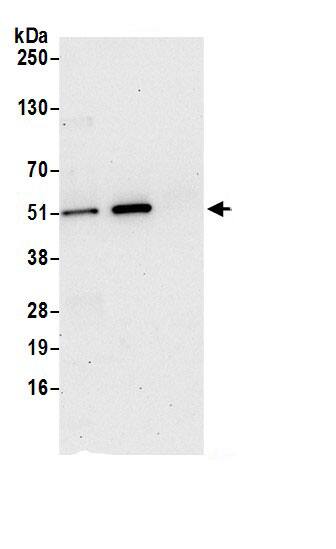 Immunoprecipitation:PGD AntibodyNBP3-29862] -Detection of human PGD by western blot of immunoprecipitates. Samples: Whole cell lysate (0.5 or 1.0 mg per IP reaction; 20% of IP loaded) from 293T cells prepared using NETN lysis buffer. Antibodies: Affinity purified rabbit anti-PGD antibody NBP3-29862 (lot NBP3-29862-1) used for IP at 6 µg per reaction. PGD was also immunoprecipitated by rabbit anti-PGD antibody BL21392. For blotting immunoprecipitated PGD, NBP3-29862 was used at 1 µg/ml. Detection: Chemiluminescence with an exposure time of 30 seconds.