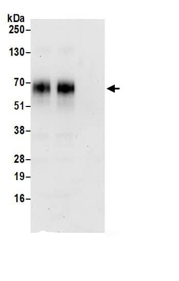 Immunoprecipitation:SLC30A1 AntibodyNBP3-29863] -Detection of human SLC30A1 by western blot of immunoprecipitates. Samples: Whole cell lysate (0.5 or 1.0 mg per IP reaction; 20% of IP loaded) from HeLa cells prepared using NETN lysis buffer. Antibodies: Affinity purified rabbit anti-SLC30A1 antibody NBP3-29863 (lot NBP3-29863-1) used for IP at 6 µg per reaction. SLC30A1 was also immunoprecipitated by rabbit anti-SLC30A1.. For blotting immunoprecipitated SLC30A1, NBP3-29863 was used at 0.4 µg/ml. Detection: Chemiluminescence with an exposure time of 30 seconds.