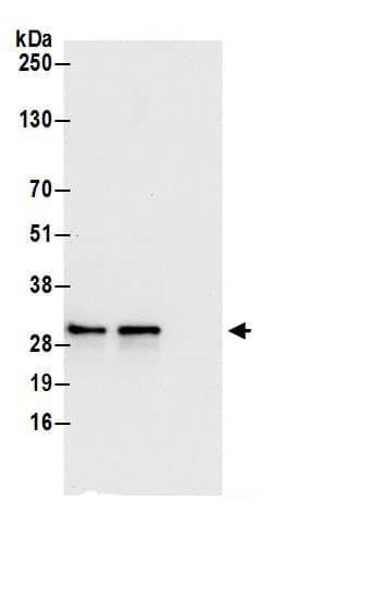 Immunoprecipitation:SRPRB AntibodyNBP3-29864] -Detection of human SRPRB by western blot of immunoprecipitates. Samples: Whole cell lysate (0.5 or 1.0 mg per IP reaction; 20% of IP loaded) from 293T cells prepared using NETN lysis buffer. Antibodies: Affinity purified rabbit anti-SRPRB antibody NBP3-29864 (lot NBP3-29864-1) used for IP at 6 µg per reaction. SRPRB was also immunoprecipitated by rabbit anti-SRPRB antibody BL21565. For blotting immunoprecipitated SRPRB, NBP3-29864 was used at 0.4 µg/ml. Detection: Chemiluminescence with an exposure time of 10 seconds.