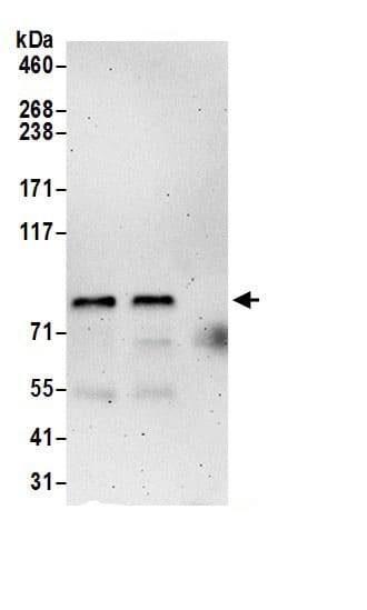 Immunoprecipitation:PCIF1 AntibodyNBP3-29865] -Detection of human PCIF1 by western blot of immunoprecipitates. Samples: Whole cell lysate (0.5 or 1.0 mg per IP reaction; 20% of IP loaded) from 293T cells prepared using NETN lysis buffer. Antibodies: Affinity purified rabbit anti-PCIF1 antibody NBP3-29865 (lot NBP3-29865-1) used for IP at 6 µg per reaction. PCIF1 was also immunoprecipitated by rabbit anti-PCIF1 antibody BL18025. For blotting immunoprecipitated PCIF1, NBP3-29865 was used at 0.4 µg/ml. Detection: Chemiluminescence with an exposure time of 3 minutes.