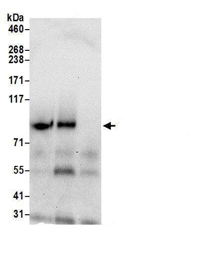 Immunoprecipitation:TMEM24 AntibodyNBP3-29868] -Detection of human C2CD2L/TMEM24 by western blot of immunoprecipitates. Samples: Whole cell lysate (0.5 or 1.0 mg per IP reaction; 20% of IP loaded) from Jurkat cells prepared using NETN lysis buffer. Antibodies: Affinity purified rabbit anti-C2CD2L/TMEM24 antibody NBP3-29868 (lot NBP3-29868-1) used for IP at 6 µg per reaction. C2CD2L/TMEM24 was also immunoprecipitated by rabbit anti-C2CD2L/TMEM24 antibody BL18109. For blotting immunoprecipitated C2CD2L/TMEM24, NBP3-29868 was used at 0.4 µg/ml. Detection: Chemiluminescence with an exposure time of 30 seconds.