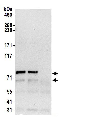 Immunoprecipitation:RUFY1 AntibodyNBP3-29870] -Detection of human RUFY1 by western blot of immunoprecipitates. Samples: Whole cell lysate (0.5 or 1.0 mg per IP reaction; 20% of IP loaded) from HeLa cells prepared using NETN lysis buffer. Antibody: Affinity purified rabbit anti-RUFY1 antibody NBP3-29870 (lot NBP3-29870-1) used for IP at 6 µg per reaction. RUFY1 was also immunoprecipitated by rabbit anti-RUFY1.. For blotting immunoprecipitated RUFY1, NBP3-29870 was used at 0.4 µg/ml. Detection: Chemiluminescence with an exposure time of 30 seconds.