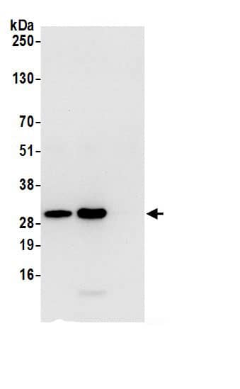 Immunoprecipitation:ETFB AntibodyNBP3-29871] -Detection of human ETFB by western blot of immunoprecipitates. Samples: Whole cell lysate (0.5 or 1.0 mg per IP reaction; 20% of IP loaded) from 293T cells prepared using NETN lysis buffer. Antibodies: Affinity purified rabbit anti-ETFB antibody NBP3-29871 (lot NBP3-29871-1) used for IP at 6 µg per reaction. ETFB was also immunoprecipitated by rabbit anti-ETFB.. For blotting immunoprecipitated ETFB, NBP3-29871 was used at 0.4 µg/ml. Detection: Chemiluminescence with an exposure time of 10 seconds.