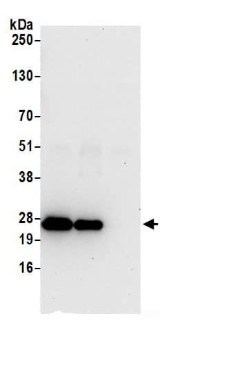 Immunoprecipitation:ATP5F1 AntibodyNBP3-29872] -Detection of human ATP5F1 by western blot of immunoprecipitates. Samples: Whole cell lysate (0.5 or 1.0 mg per IP reaction; 20% of IP loaded) from 293T cells prepared using NETN lysis buffer. Antibodies: Affinity purified rabbit anti-ATP5F1 antibody NBP3-29872 (lot NBP3-29872-1) used for IP at 6 µg per reaction. ATP5F1 was also immunoprecipitated by rabbit anti-ATP5F1.. For blotting immunoprecipitated ATP5F1, NBP3-29872 was used at 1 µg/ml. Detection: Chemiluminescence with an exposure time of 10 seconds.