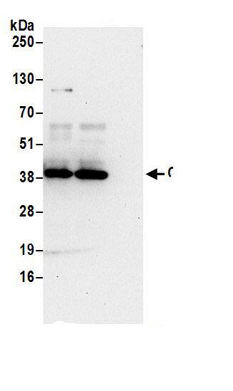 Immunoprecipitation:CDV3 AntibodyNBP3-29874] -Detection of human CDV3 by western blot of immunoprecipitates. Samples: Whole cell lysate (0.5 or 1.0 mg per IP reaction; 20% of IP loaded) from 293T cells prepared using NETN lysis buffer. Antibodies: Affinity purified rabbit anti-CDV3 antibody NBP3-29874 (lot NBP3-29874-1) used for IP at 6 µg per reaction. CDV3 was also immunoprecipitated by rabbit anti-CDV3.. For blotting immunoprecipitated CDV3, NBP3-29874 was used at 1 µg/ml. Detection: Chemiluminescence with an exposure time of 30 seconds.