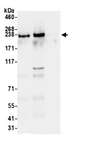 Immunoprecipitation:BAP28 AntibodyNBP3-29875] -Detection of human HEATR1 by western blot of immunoprecipitates. Samples: Whole cell lysate (0.5 or 1.0 mg per IP reaction; 20% of IP loaded) from 293T cells prepared using NETN lysis buffer. Antibodies: Affinity purified rabbit anti-HEATR1 antibody NBP3-29875 (lot NBP3-29875-1) used for IP at 6 µg per reaction. HEATR1 was also immunoprecipitated by rabbit anti-HEATR1 antibody BL19992. For blotting immunoprecipitated HEATR1, NBP3-29875 was used at 0.4 µg/ml. Detection: Chemiluminescence with an exposure time of 3 seconds.