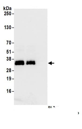 Immunoprecipitation:LAT AntibodyNBP3-29876] -Detection of human LAT by western blot of immunoprecipitates. Samples: Whole cell lysate (1.0 mg per IP reaction; 20% of IP loaded) from Jurkat cells prepared using NETN lysis buffer. Antibodies: Affinity purified rabbit anti-LAT antibody (NBP3-29876 lot 1) used for IP at 1 µg per reaction. LAT was also immunoprecipitated by rabbit anti-LAT antibody BL24655. For blotting immunoprecipitated LAT, NBP3-29876 was used at 0.04 mg/ml. Detection: Chemiluminescence with an exposure time of 1 second.