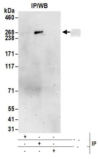 Immunoprecipitation:[NBP3-29877]-Detection of human ASCC3 by western blot of immunoprecipitates. Samples: Whole cell lysate from HEK293T cells. Antibodies: Affinity purified rabbit anti-ASCC3 antibody used for IP at 6 µg/mg lysate. ASCC3 was inefficiently immunoprecipitated by rabbit anti-ASCC3 antibody. For blotting immunoprecipitated ASCC3, was used at 1 µg/ml. Detection: Chemiluminescence with an exposure time of 3 minutes.