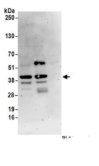 Immunoprecipitation:SLBP AntibodyNBP3-29878] -Detection of human SLBP by western blot of immunoprecipitates. Samples: Whole cell lysate (1 mg for IP; 20% of IP loaded) from HEK293T cells. Antibodies: Affinity purified rabbit anti-SLBP antibody NBP3-29878 (lot NBP3-29878-1) used for IP at 6 µg/mg lysate. SLBP was also immunoprecipitated by rabbit anti-SLBP antibody BL14232. For blotting immunoprecipitated SLBP, NBP3-29878 was used at 1 µg/ml. Detection: Chemiluminescence with an exposure time of 3 minutes.