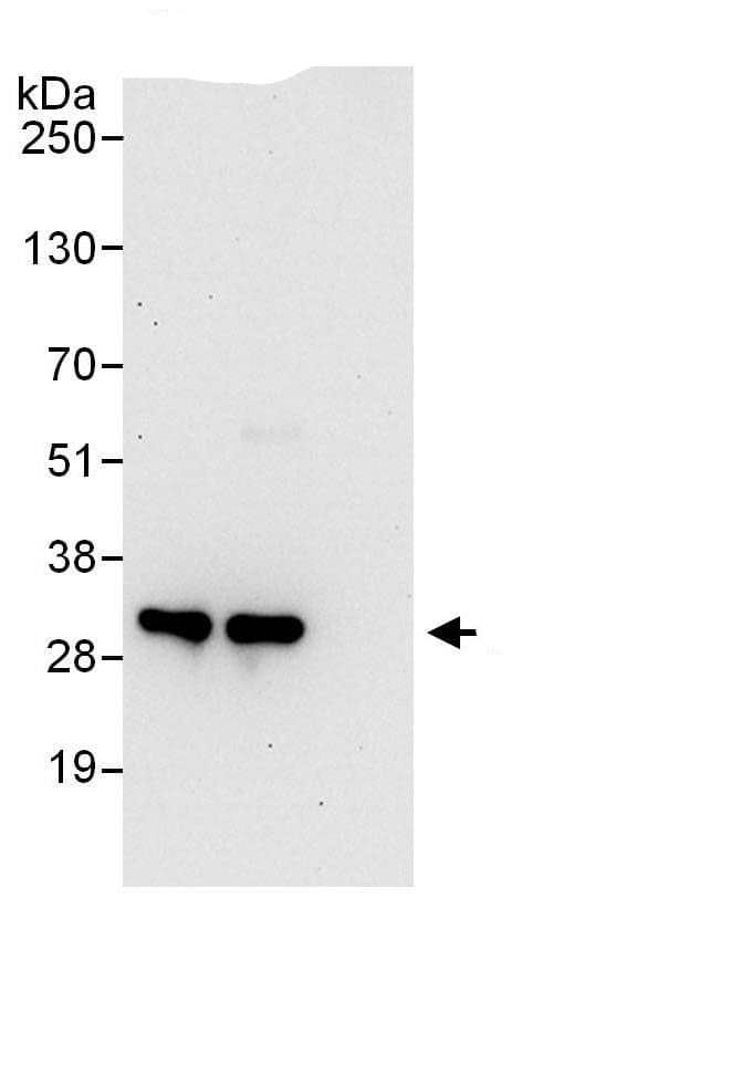 Immunoprecipitation:PSMF1 AntibodyNBP3-29879] -Detection of human PSMF1 by western blot of immunoprecipitates. Samples: Whole cell lysate (1 mg for IP; 20% of IP loaded) from HEK293T cells. Antibodies: Affinity purified rabbit anti-PSMF1 antibody NBP3-29879 (lot NBP3-29879-1) used for IP at 6 µg/mg lysate. PSMF1 was also immunoprecipitated by rabbit anti-PSMF1.. For blotting immunoprecipitated PSMF1, NBP3-29879 was used at 1 µg/ml. Detection: Chemiluminescence with an exposure time of 30 seconds.