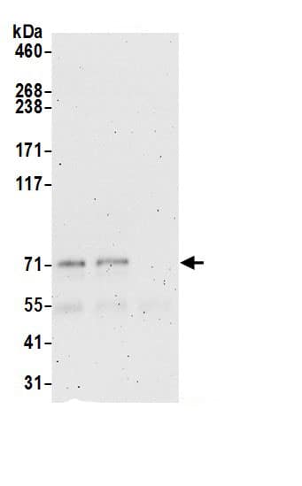 Immunoprecipitation:EXOC5 AntibodyNBP3-29880] -Detection of human EXOC5 by western blot of immunoprecipitates. Samples: Whole cell lysate (0.5 or 1.0 mg per IP reaction; 20% of IP loaded) from HeLa cells prepared using NETN lysis buffer. Antibodies: Affinity purified rabbit anti-EXOC5 antibody NBP3-29880 (lot NBP3-29880-1) used for IP at 6 µg per reaction. EXOC5 was also immunoprecipitated by rabbit anti-EXOC5 antibody BL21944. For blotting immunoprecipitated EXOC5, NBP3-29880 was used at 1 µg/ml. Detection: Chemiluminescence with an exposure time of 3 minutes.