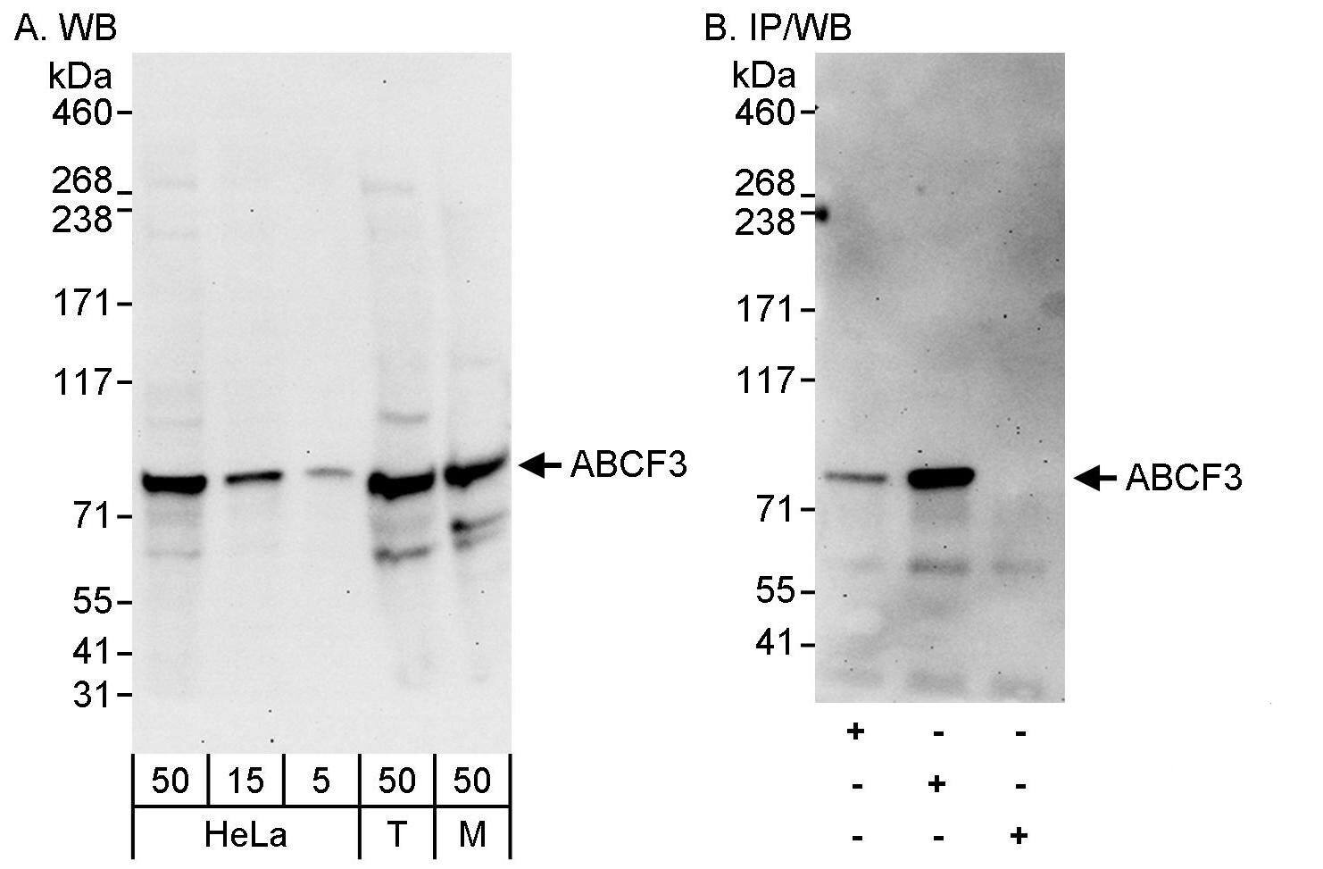 Western Blot:[NBP3-29881]-Detection of human and mouse ABCF3 by western blot and immunoprecipitation. Samples: Whole cell lysate from HeLa , HEK293T , and mouse NIH 3T3 cells. Antibodies: Affinity purified rabbit anti-ABCF3 antibody used for WB at 0. 1 µg/ml and 0. 4 µg/ml and used for IP at 3 µg/mg lysate. ABCF3 was less efficiently immunoprecipitated by rabbit anti-ABCF3 antibody , which recognizes an upstream epitope. Detection: Chemiluminescence with exposure times of 30 seconds and 3 minutes.