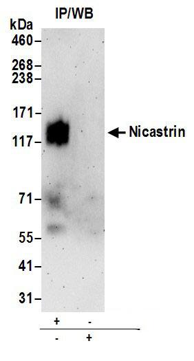 Immunoprecipitation:[NBP3-29882]-Detection of human Nicastrin by western blot of immunoprecipitates. Samples: Whole cell lysate from HeLa cells prepared using RIPA lysis buffer. Antibodies: Affinity purified rabbit anti-Nicastrin antibody used for IP at 6 µg per reaction. For blotting immunoprecipitated Nicastrin, was used at 1 µg/ml. Detection: Chemiluminescence with an exposure time of 3 minutes.