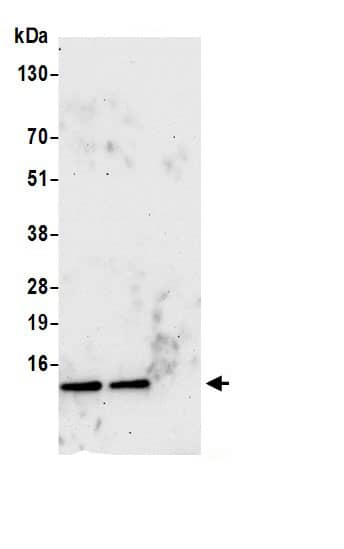 Immunoprecipitation:NDUFA5 AntibodyNBP3-29884] -Detection of human NDUFA5 by western blot of immunoprecipitates. Samples: Whole cell lysate (0.5 or 1.0 mg per IP reaction; 20% of IP loaded) from 293T and cells prepared using NETN lysis buffer. Antibodies: Affinity purified rabbit anti-NDUFA5 antibody NBP3-29884 (lot NBP3-29884-1) used for IP at 6 µg per reaction. NDUFA5 was also immunoprecipitated by rabbit anti-NDUFA5 antibody. For blotting immunoprecipitated NDUFA5, NBP3-29884 was used at 0.4 µg/ml. Detection: Chemiluminescence with an exposure time of 75 seconds.